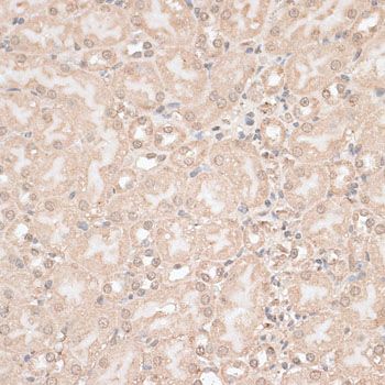 Immunohistochemistry - GPKOW antibody (144-013214)
