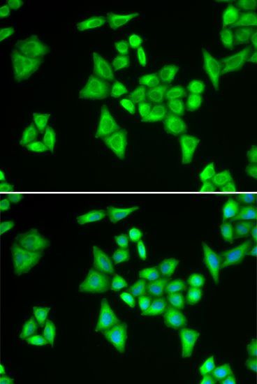 Immunofluorescence - ADSL Polyclonal Antibody (144-06278)