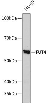 Western blot