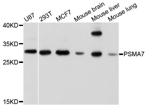 Western blot - PSMA7 antibody (144-04052)