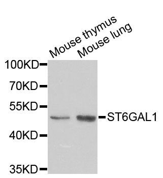 Western blot - ST6GAL1 antibody (144-05754)
