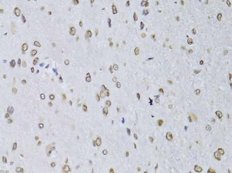 Immunohistochemistry - LMNB2 Polyclonal Antibody (144-06483)