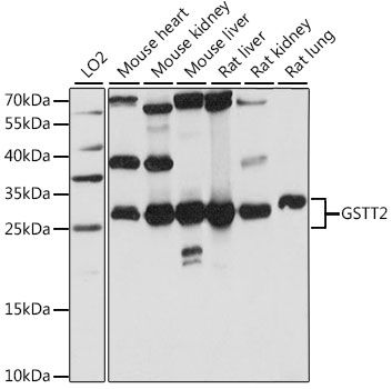 Western blot - GSTT2 antibody (144-015678)
