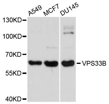 Western blot - VPS33B antibody (144-08799)