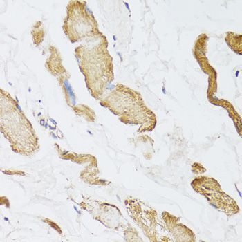 Immunohistochemistry - CKMT2 antibody (144-08088)