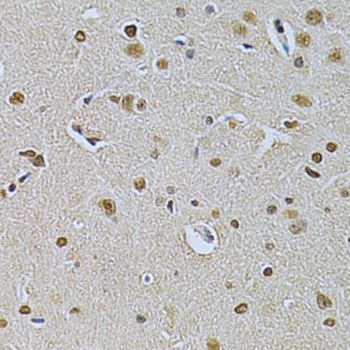 Immunohistochemistry - ILK Polyclonal Antibody (144-00901)