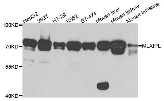 Western blot - MLXIPL Polyclonal Antibody (144-07630)