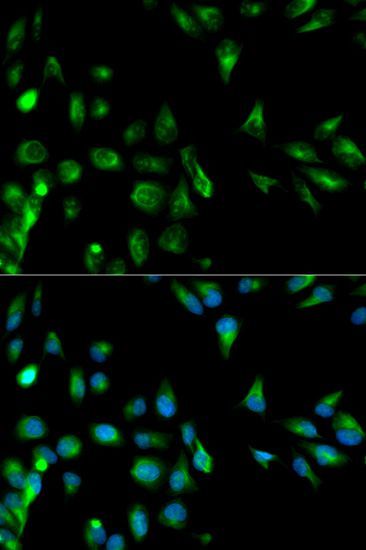 Immunofluorescence - RASSF1 antibody (144-01203)