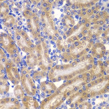 Immunohistochemistry - SHC1 antibody (144-07725)