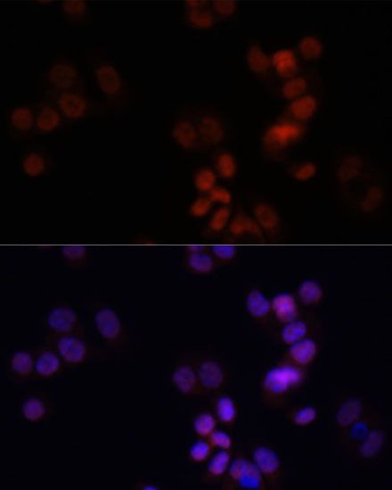 Western blot