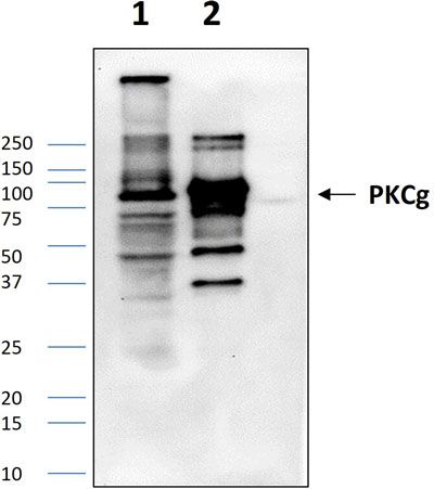 Western blot
