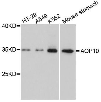 Western blot - AQP10 antibody (144-02888)