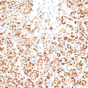 Western blot - KLHL9 Polyclonal Antibody (144-010149)
