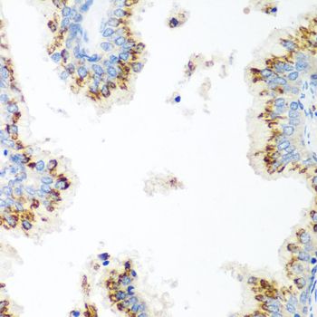 Immunohistochemistry - UBIAD1 antibody (144-07640)
