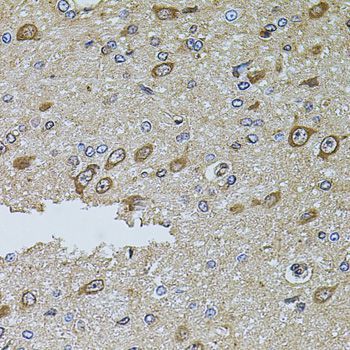 Immunohistochemistry - MTIF3 antibody (144-08524)