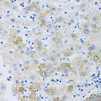 Immunohistochemistry - SLC4A5 Polyclonal Antibody (144-010436)