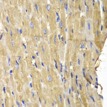 Immunohistochemistry - PLCG2 Polyclonal Antibody (144-02182)