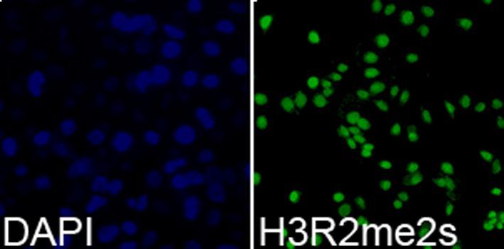 Immunofluorescence - Symmetric DiMethyl-Histone H3-R2 pAb (144-02373)