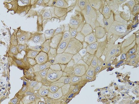 Immunohistochemistry - GGT1 antibody (144-01776)