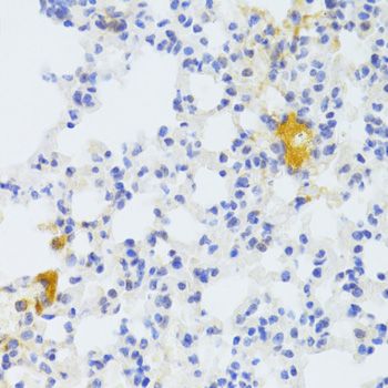 Immunohistochemistry - FAS Polyclonal Antibody (144-00233)