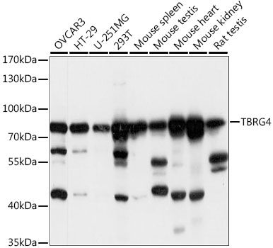 Western blot - TBRG4 antibody (144-015753)