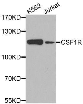 Western blot - CSF1R antibody (144-03019)