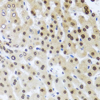 Immunohistochemistry - RAD23B Polyclonal Antibody (144-01034)