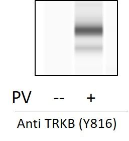 TrkB (Tyr816) - Western Blot