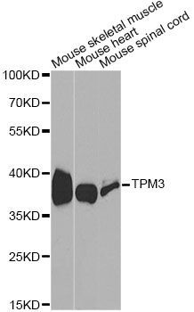 Western blot - TPM3 antibody (144-01206)