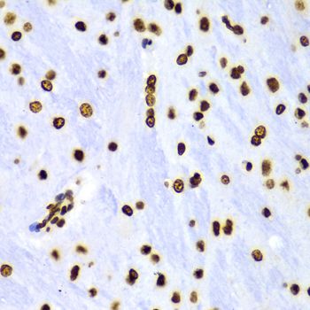 Immunohistochemistry - DiMethyl-Histone H3-K4 pAb (144-61340)