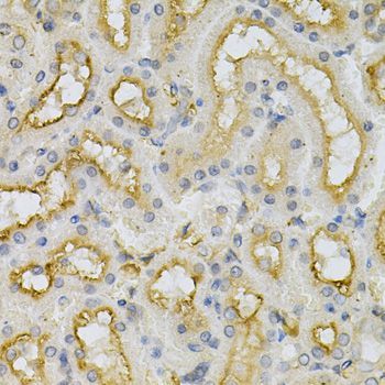 Immunohistochemistry - FHL1 Antibody (144-05460)