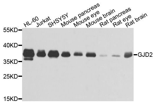 Western blot - GJD2 antibody (144-02883)