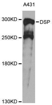 Western blot - DSP Polyclonal Antibody (144-60272)