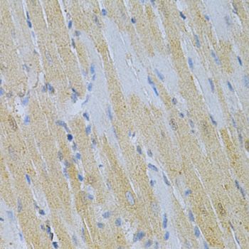 Immunohistochemistry - TNFRSF11B Polyclonal Antibody (144-02100)
