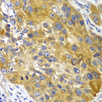 Immunohistochemistry - AK1 Polyclonal Antibody (144-01218)