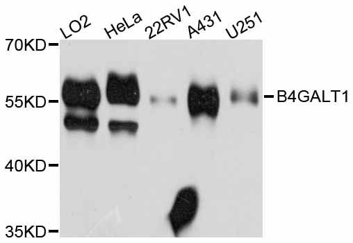 Western blot - B4GALT1 Polyclonal Antibody (144-08546)
