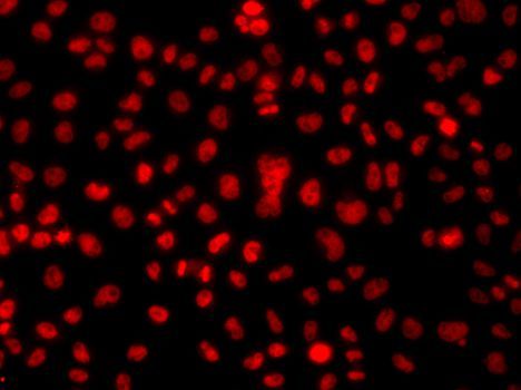 Immunofluorescence - HNRNPA1 Polyclonal Antibody (144-07491)