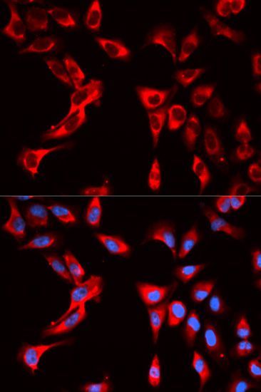 Immunofluorescence - EIF4B antibody (144-013300)