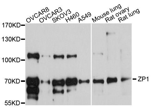 Western blot - ZP1 Polyclonal Antibody (144-10776)