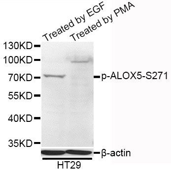 Western blot - Phospho-ALOX5-S271 antibody (144-50573)