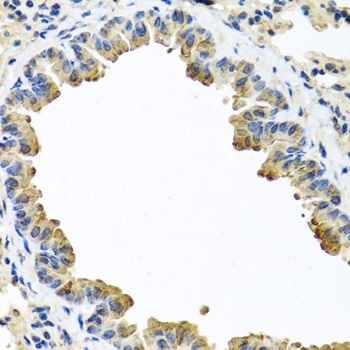 Immunohistochemistry - SERPINA3 Polyclonal Antibody (144-01021)