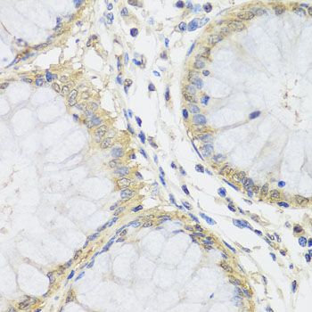 Immunohistochemistry - MTX1 antibody (144-07912)