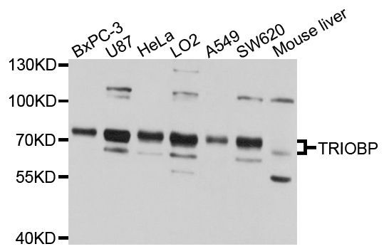 Western blot - TRIOBP antibody (144-04485)