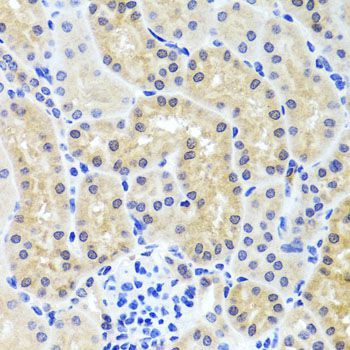 Immunohistochemistry - INADL antibody (144-08476)