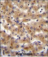 IHC-P