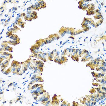 Immunohistochemistry - SERPINA10 Polyclonal Antibody (144-07106)