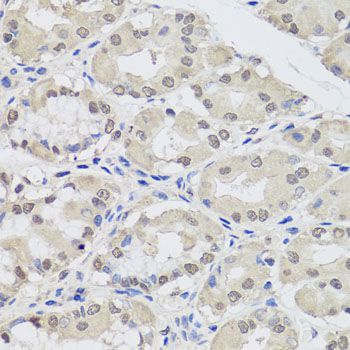 Immunohistochemistry - AGO2 antibody (144-06802)