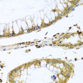 Immunohistochemistry - PMPCB antibody (144-04312)