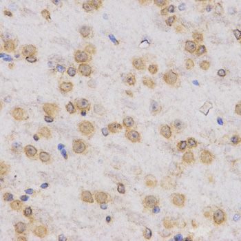 Immunohistochemistry - TriMethyl-Histone H3-K36 pAb (144-02366)