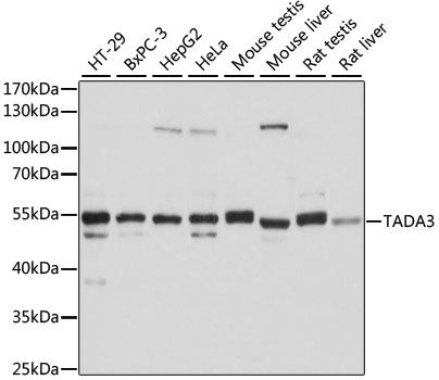 Western blot - TADA3 antibody (144-61436)